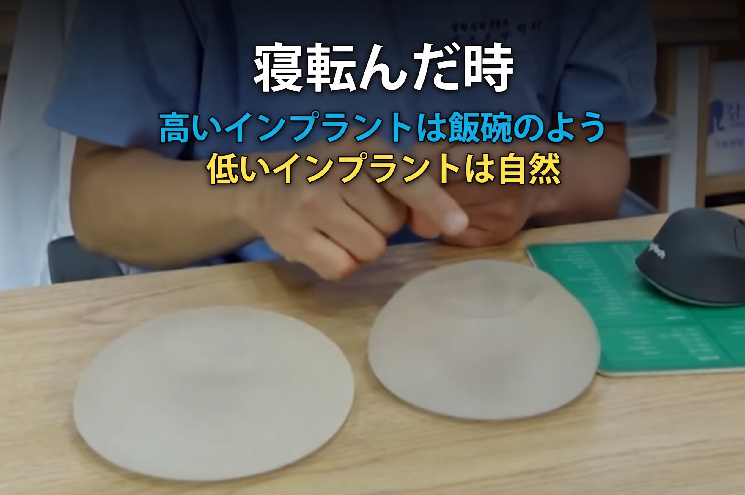 豊胸手術の決定時に重要な2つのポイントとは? (8)