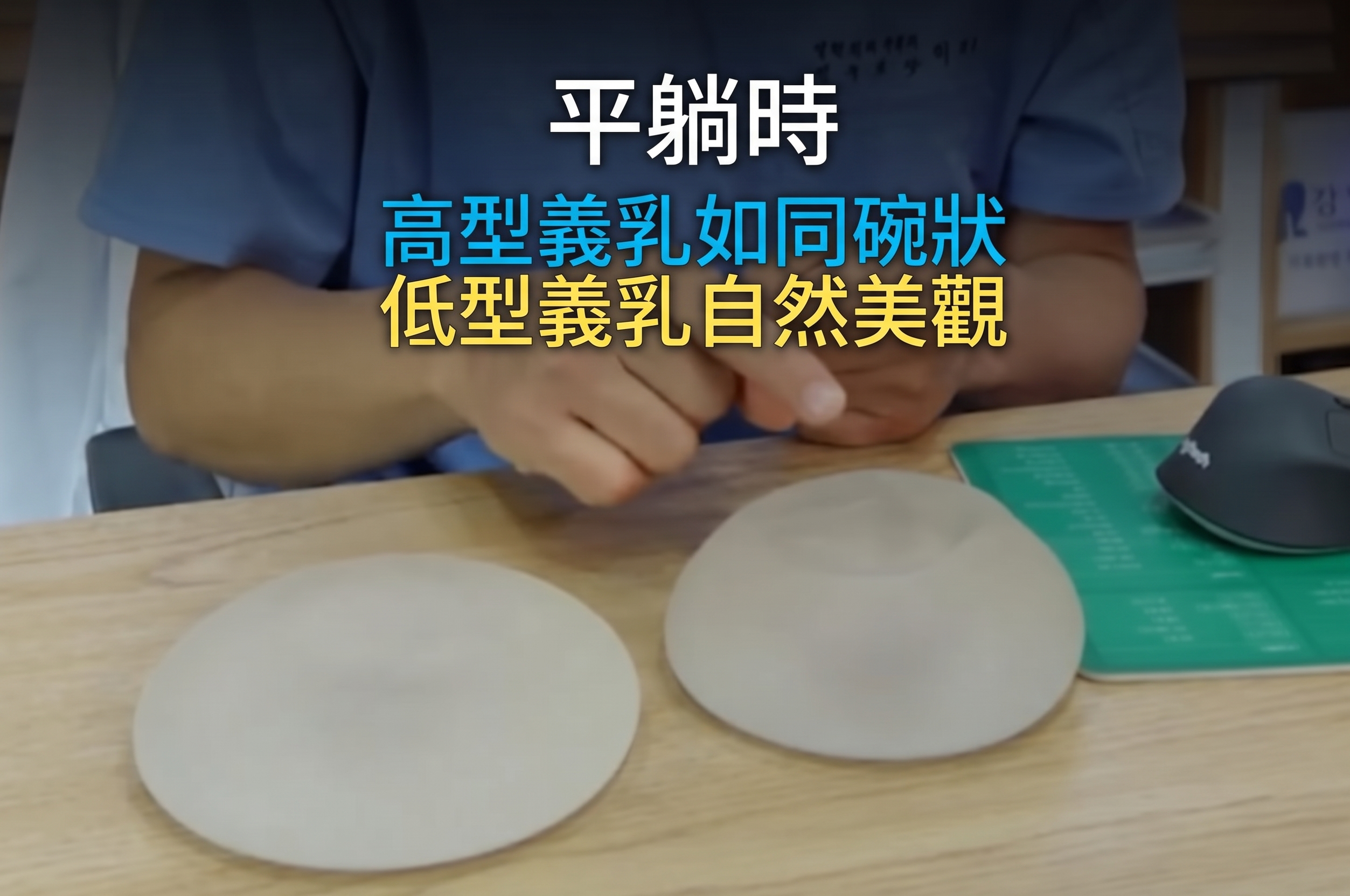決定植入物隆乳手術時的兩大關鍵？ (8)